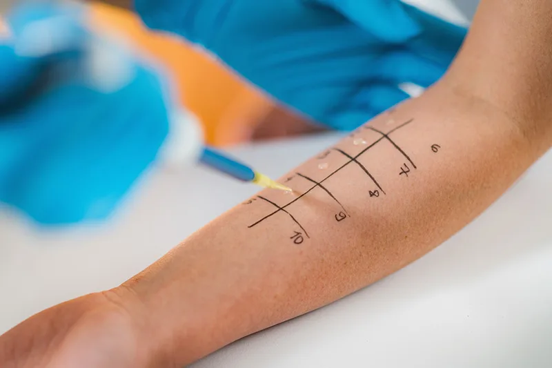 Jak wygląda uczulenie na płyn do płukania? Zobacz jakie są najbardziej popularne objawy